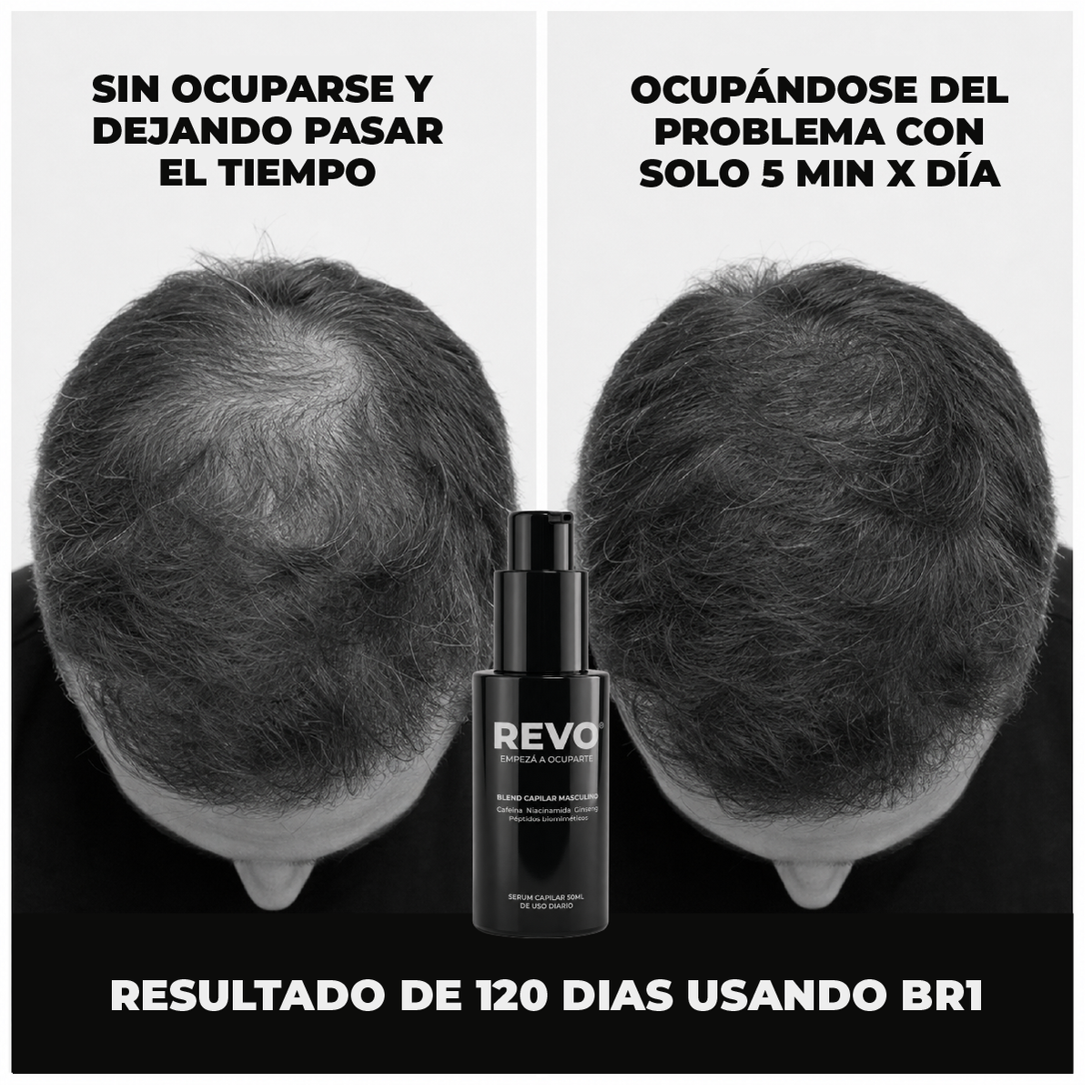 BR1 - BLEND CAPILAR MASCULINO
