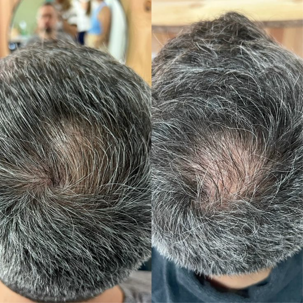 Resultado 